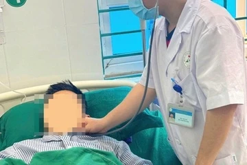 Culi: Loài thú có nọc độc hiếm gặp ở rừng Việt Nam Culi: Loài thú có nọc độc hiếm gặp ở rừng Việt Nam